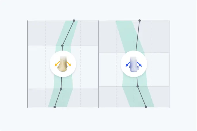 анализ на движение - пронация и супинация